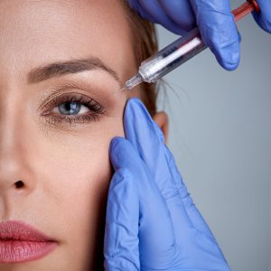 Portrait of a woman during surgery filling facial wrinkles, cosmetic is injected into skin around eyes